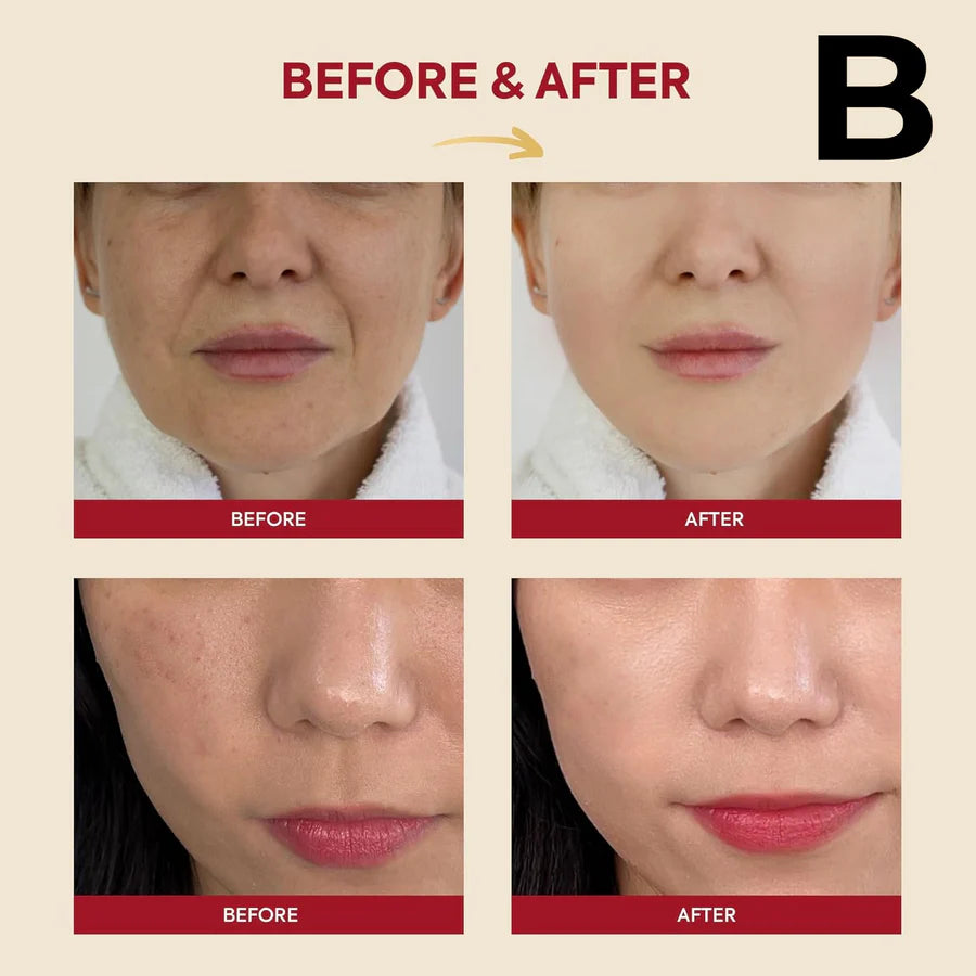 KSECRET-SERUM FACIAL SEOUL 1988 ESSENCE: 97 BABA DE CARACOL + ARROZ