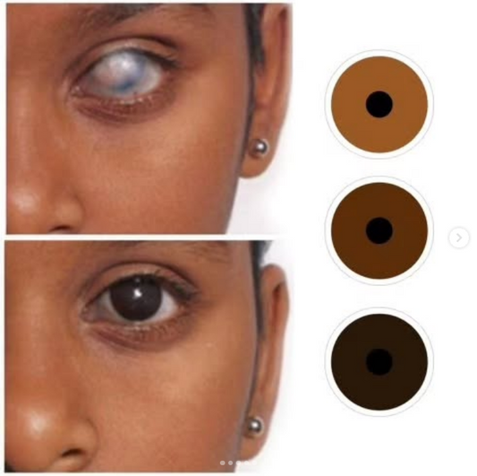 LENTES DE CONTACTO PROTÉSICOS